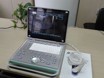 Mikro - dışbükey sonda ile 3D dijital dizüstü taşınabilir ultrason tarayıcı